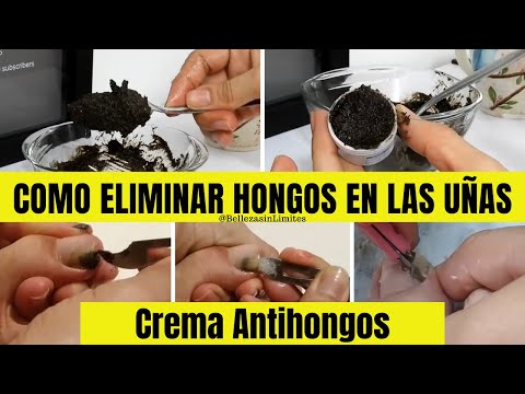 vaporub para los hongos de las unas