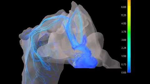 Dynamic Streamline Simulation of Nasal Flow Part 6