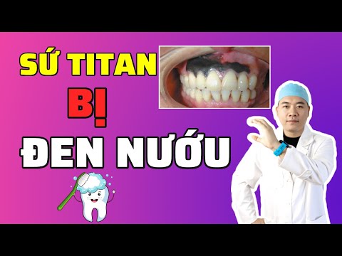 Video: Không Có Titan