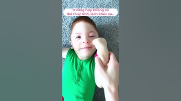 BAO NHIÊU TUỔI trẻ có thể dùng KÍNH ÁP TRÒNG? #fsec #eyeclinic #matkhoe #doimat