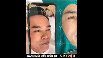 NÂNG MŨI CẤU TRÚC 4D - Đã nâng là đẹp!