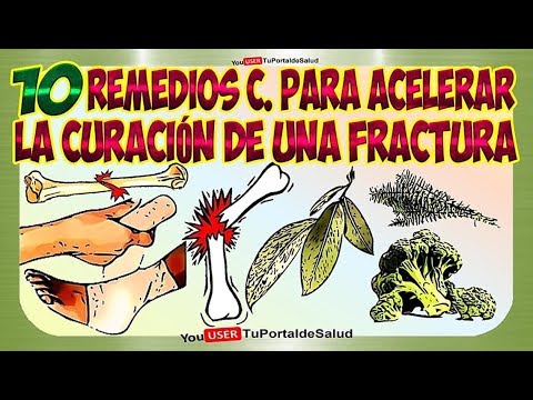 Vídeo: Fracturas: Tratamiento De Fracturas Con Remedios Caseros Y Métodos De Medicina Tradicional