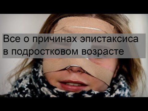 Все о причинах эпистаксиса в подростковом возрасте