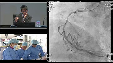 [TCTAP 2018] Master the CTO - Live Case Session II