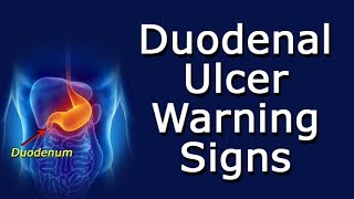 Duodenal Ulcer Warning Signs
