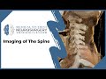 Imaging of the spine