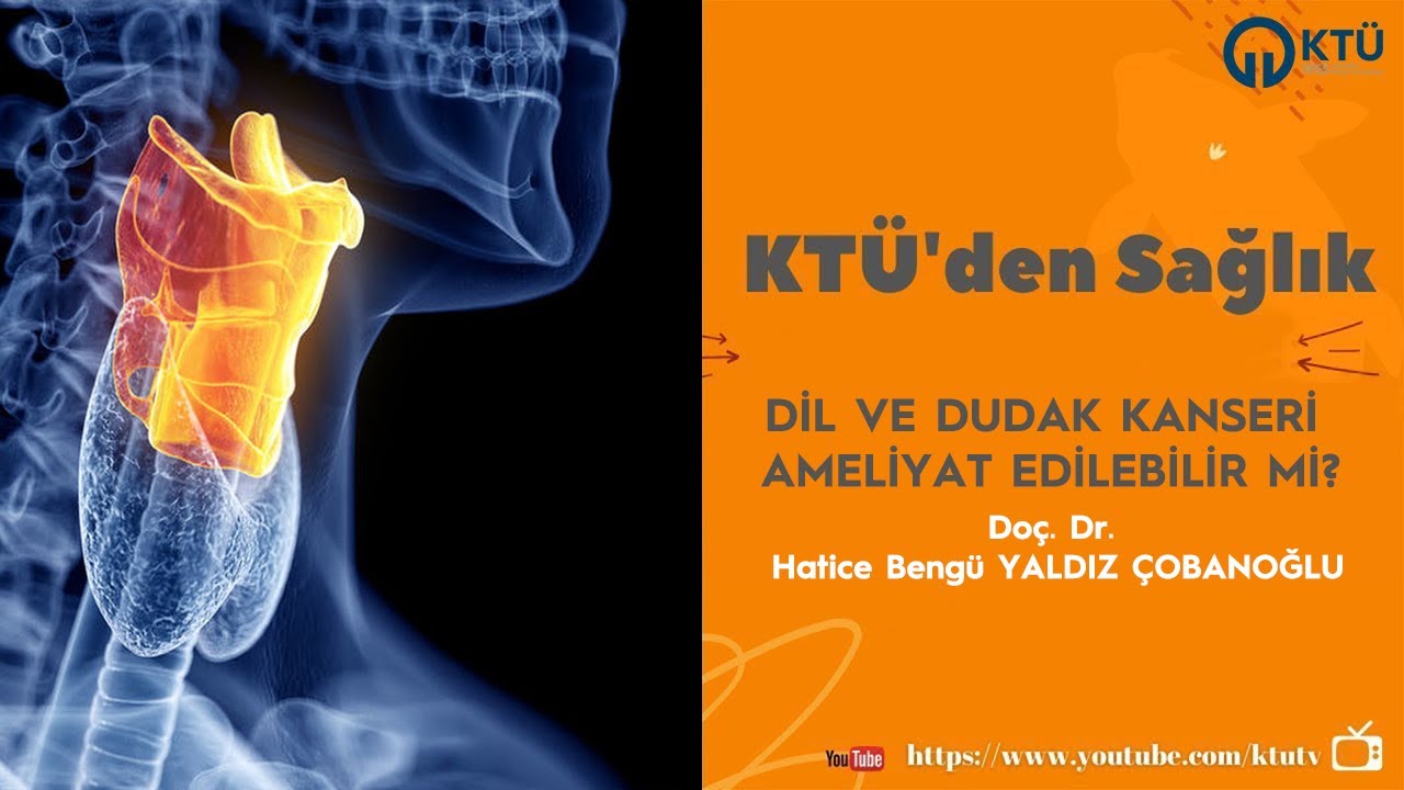 Dil ve Dudak Kanseri Ameliyat Edilebilir Mi