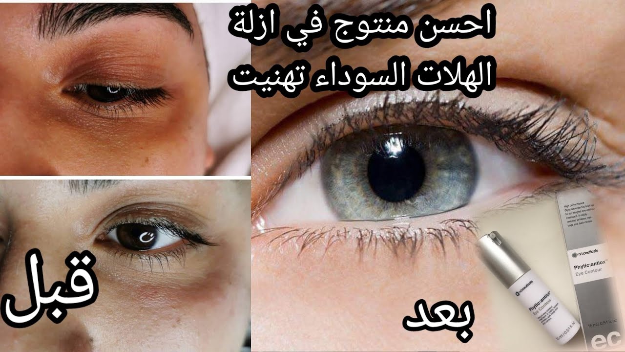 بغيتي تهناي من الهالات السوداء عليك بهاد برودوي الخطير  لي غادي يهنيك كيف ما هناني