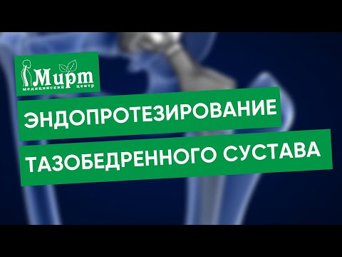 Операция по эндопротезирование тазобедренного сустава. Замена тазобедренного сустава.