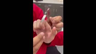 Rom Testing, Digit Mp Flexion, Pip Flexion, Dip Flexion, Thumbcmc Abduction And Thumbcmc Flexion
