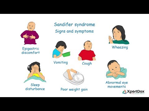 Sandifer syndrome