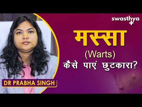 मस्से को जड़ से हटाए | Dr Prabha Singh on Treatment of Warts in Hindi | Types & Prevention