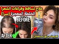 الحل الشامل لكل مشاكل شعرك في خلطة واحدة تساقط فراغات تقصف
