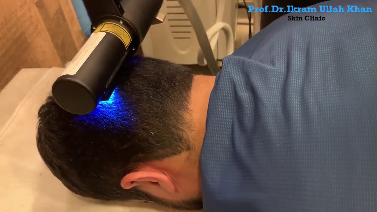 Scalp Psoriasis Treatment by Prof. Dr. Ikram Ullah Khan