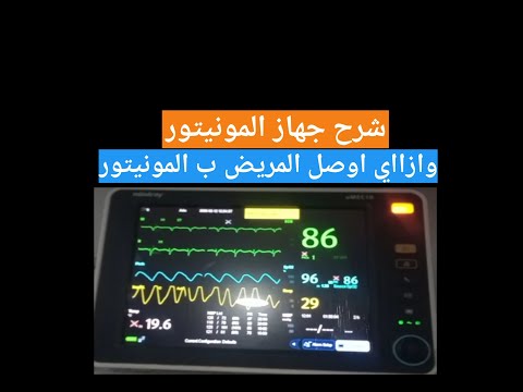 شرح جهاز المونيتور ازاي اوصل المريض بالمونيتور