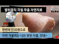 단30원👌발뒤꿈치 무좀 각질 곰팡이 간단 빠른 제거 꿀팁~