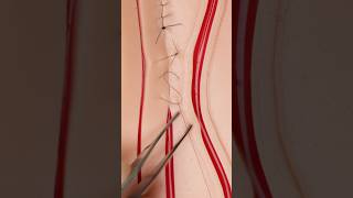 Ford Interlocking Surgical Suture #goodtoknow #suturing #stitches #vet #medicine #surgery #surgeon