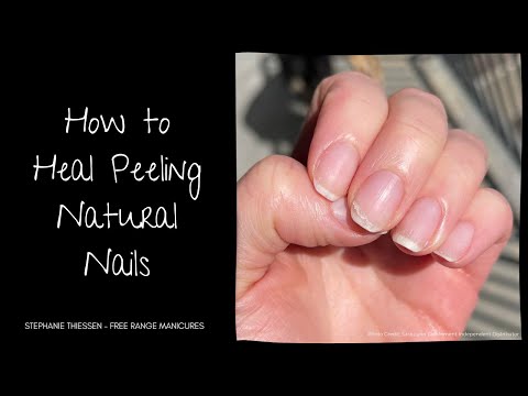 Understanding Peeling Nails: What Your Nails are Trying to Tell You -  YouTube