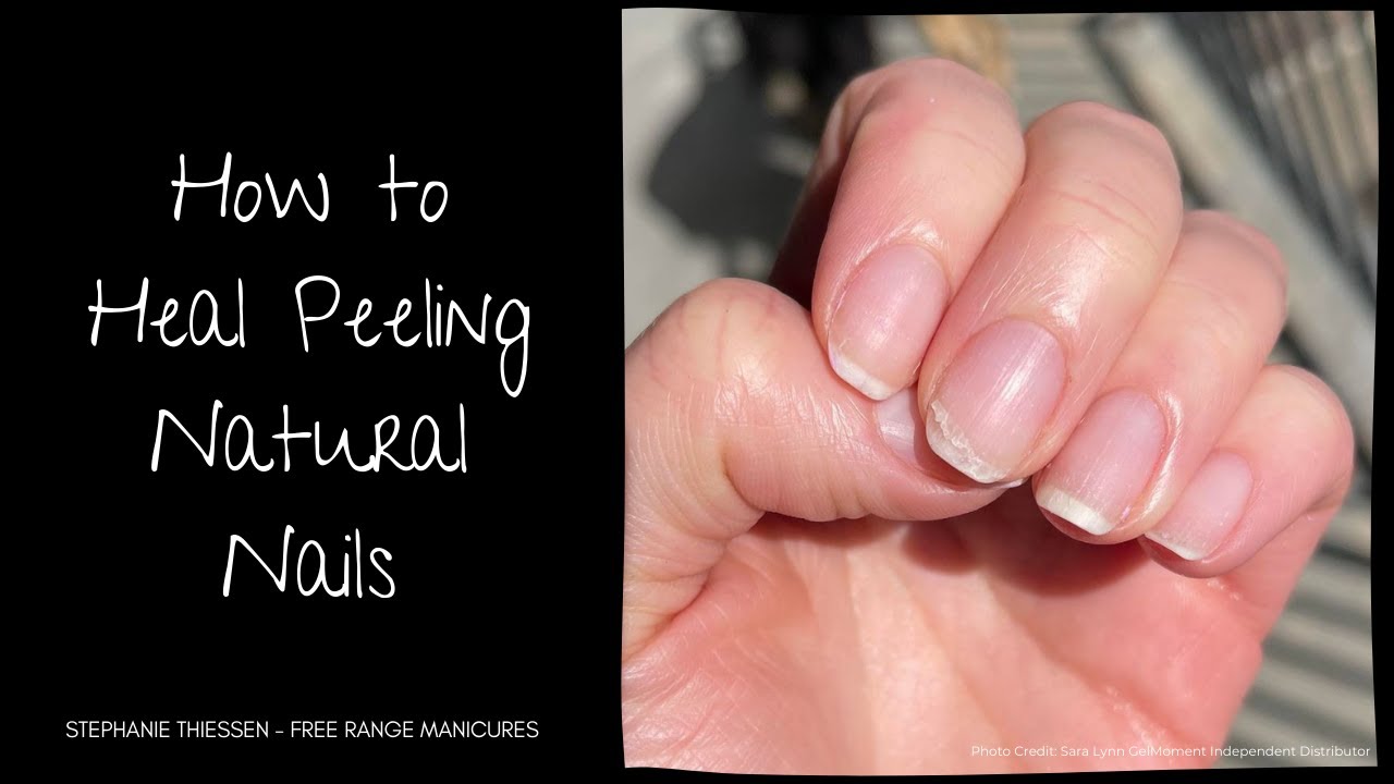 12+ Easy & Quick Tips to Treat and Prevent Peeling Cuticles
