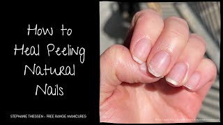 How to Heal Peeling Natural Nails