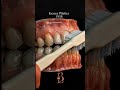 A evolução da Escova de Dente🪥