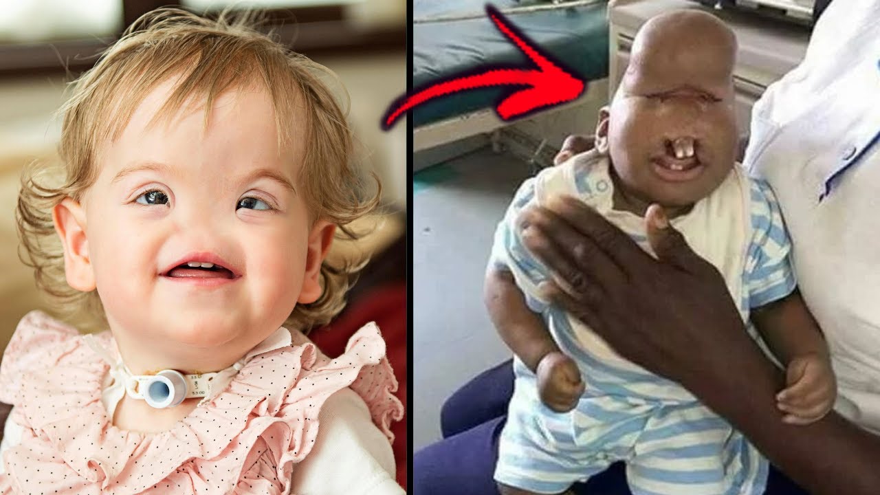 10 Unusual Babies You Wont Believe Actually Exist Youtube