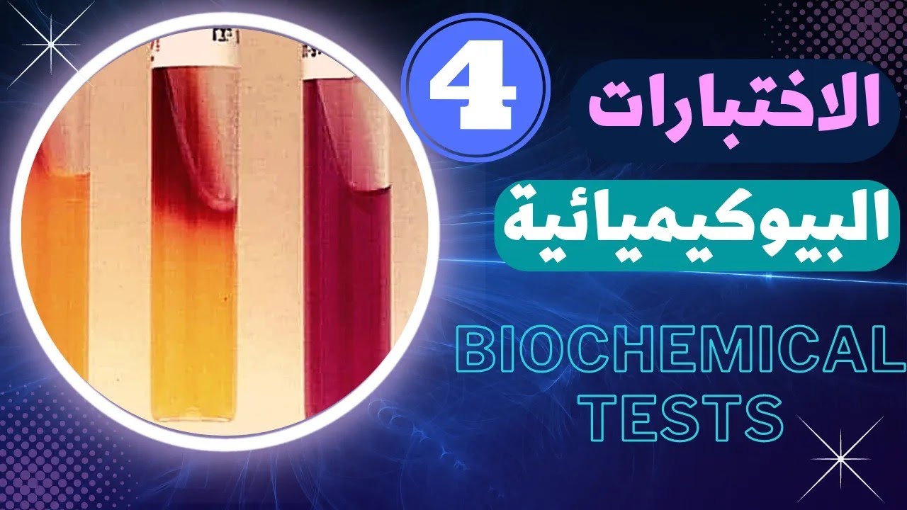 44_طريقة التعرف علي البكتيريا بالاختبارات البيوكيميائية Biochemical test !!!!