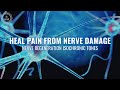 Chronic Nerve Pain Relief | Nerve Regeneration Isochronic Tones | Heal Pain from Nerve Damage-528Hz