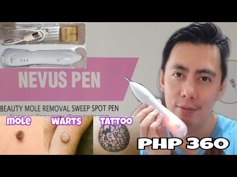 Video: Aparatas tatuiruočių, papilomų, randų šalinimui - Kosmetinis rašiklis su lazeriu - Skin Cleaner, Evo Beauty