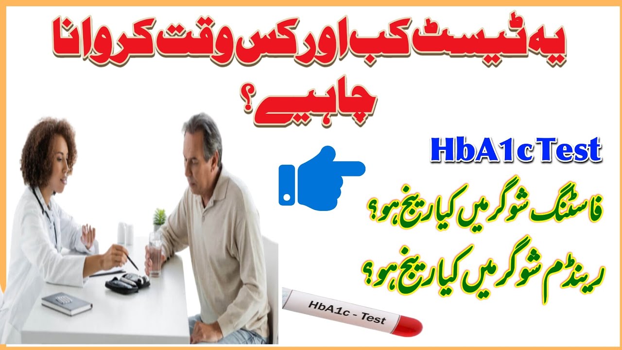When and how should HBA1C test be done? Fasting sugar and random