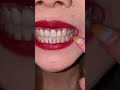 关注美女姐姐口腔健康口腔检查牙齿喉咙扁桃体欣赏了解更多 关注美女姐姐口腔健康口腔检查牙齿喉咙扁桃体欣赏了解更多