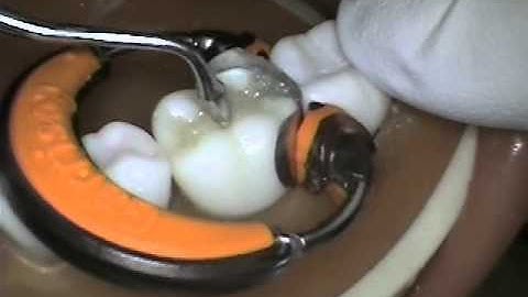 #19 Class II composite video with Garrison system