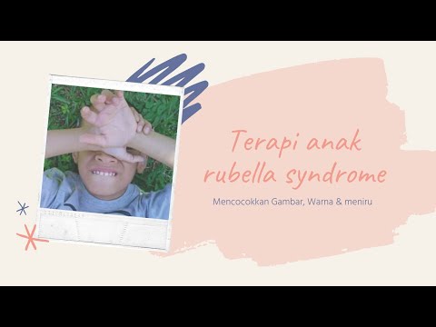 terapi-anak-berkebutuhan-khusus,-rubella-syndrom-2