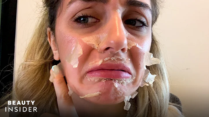 What It’s Like To Get A Chemical Peel For Acne Scars | Beauty Explorers | Beauty Insider - DayDayNews
