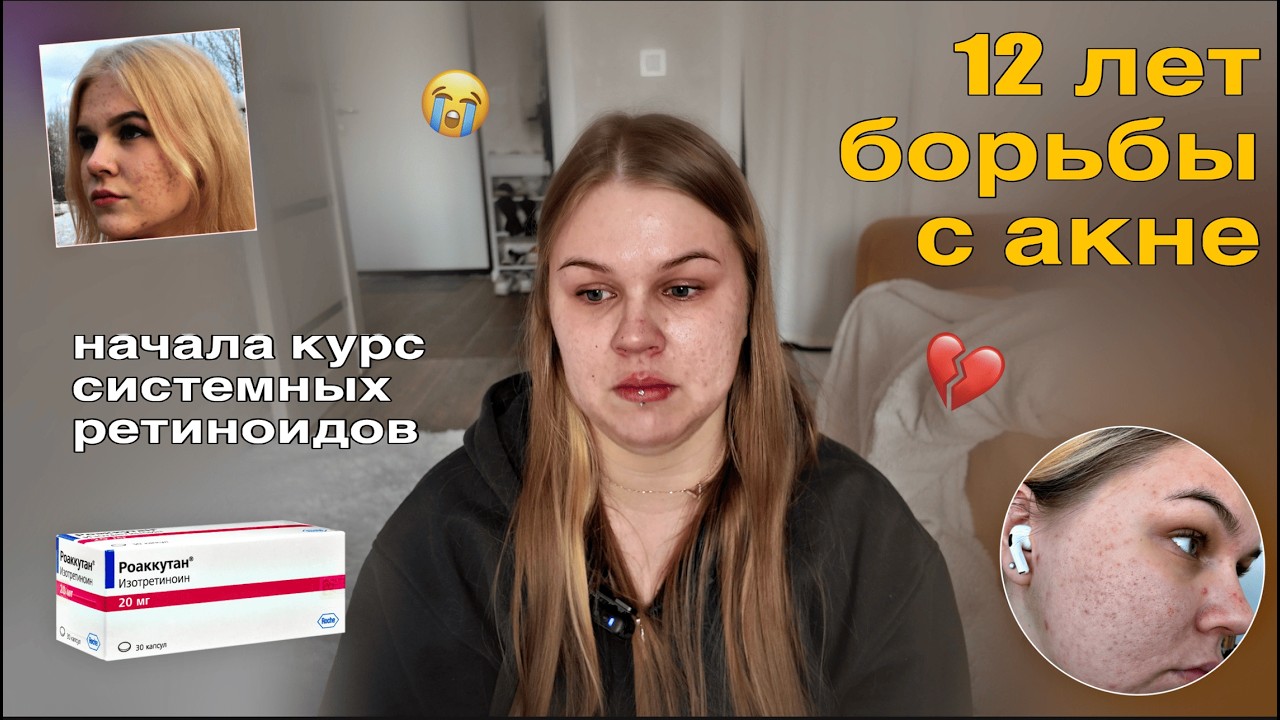 12 лет АКНЕ💔  начало курса системных ретиноидов🧪  цены, анализы, ДО/ПОСЛЕ, 1 ЧАСТЬ
