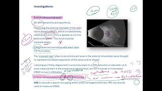 C-scan Vs B-scan ultrasonography in Papilloedema!