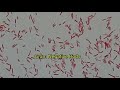 Gram Negative Rods/ Bacilli of Klebsiella pneumoniae under the Microscope