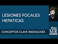 11 Lesiones focales hepáticas