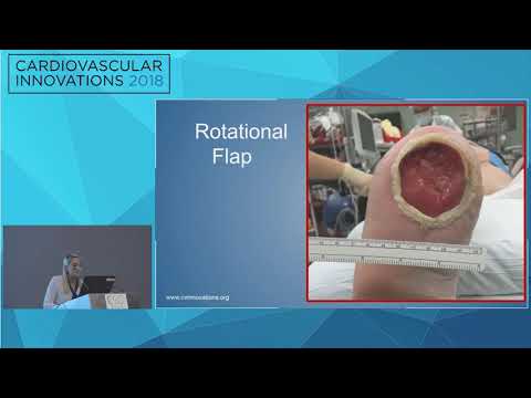 CVI2018 Session: Podiatry Resident Case Competition