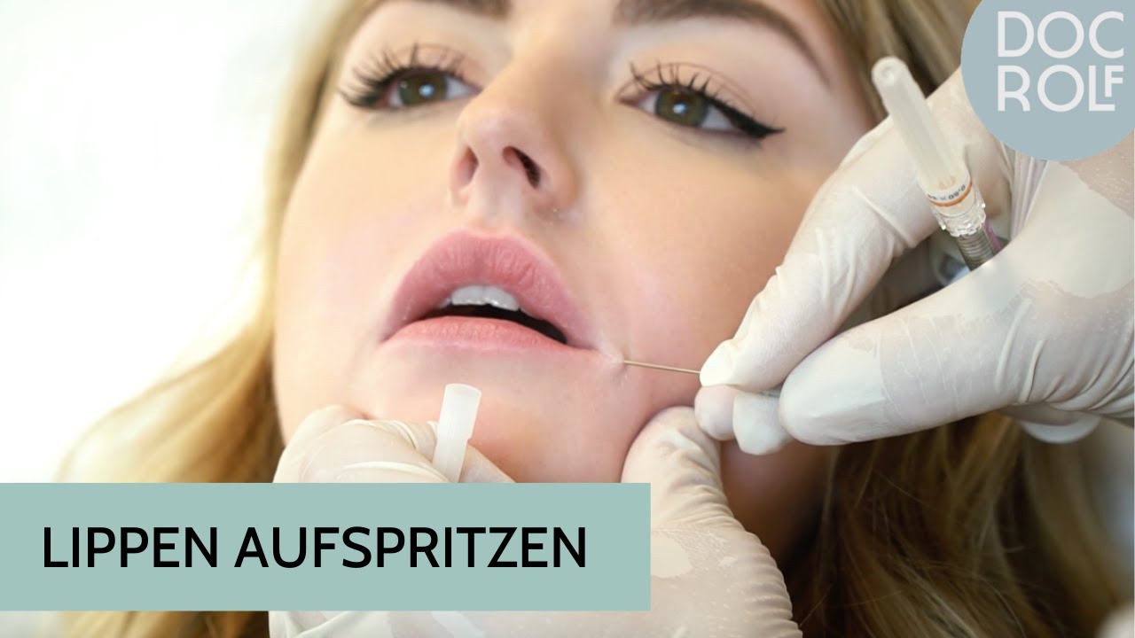 LIPPEN AUFSPRITZEN erklärt - die Behandlung und Vorher-Nachher Ergebnis - Dr. Rolf Bartsch - YouTube LIPPEN AUFSPRITZEN erklärt - die Behandlung und Vorher-Nachher Ergebnis - Dr. Rolf Bartsch - YouTube