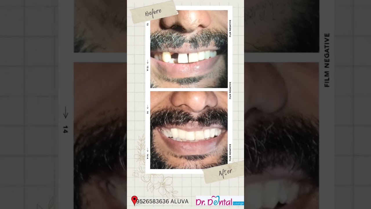 9526582636 DR DENTAL LOUNGE MARAMPALLY ALUVA 