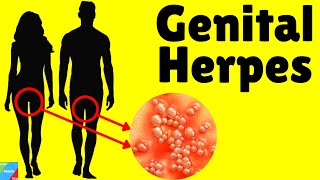 Herpes | Genital Herpes - Signs \u0026 Symptoms, Causes, Pathophysiology, Diagnosis, Treatment