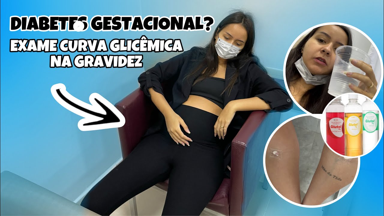 Resultado Curva Glicêmica Gestante 60 Minutos - RETOEDU