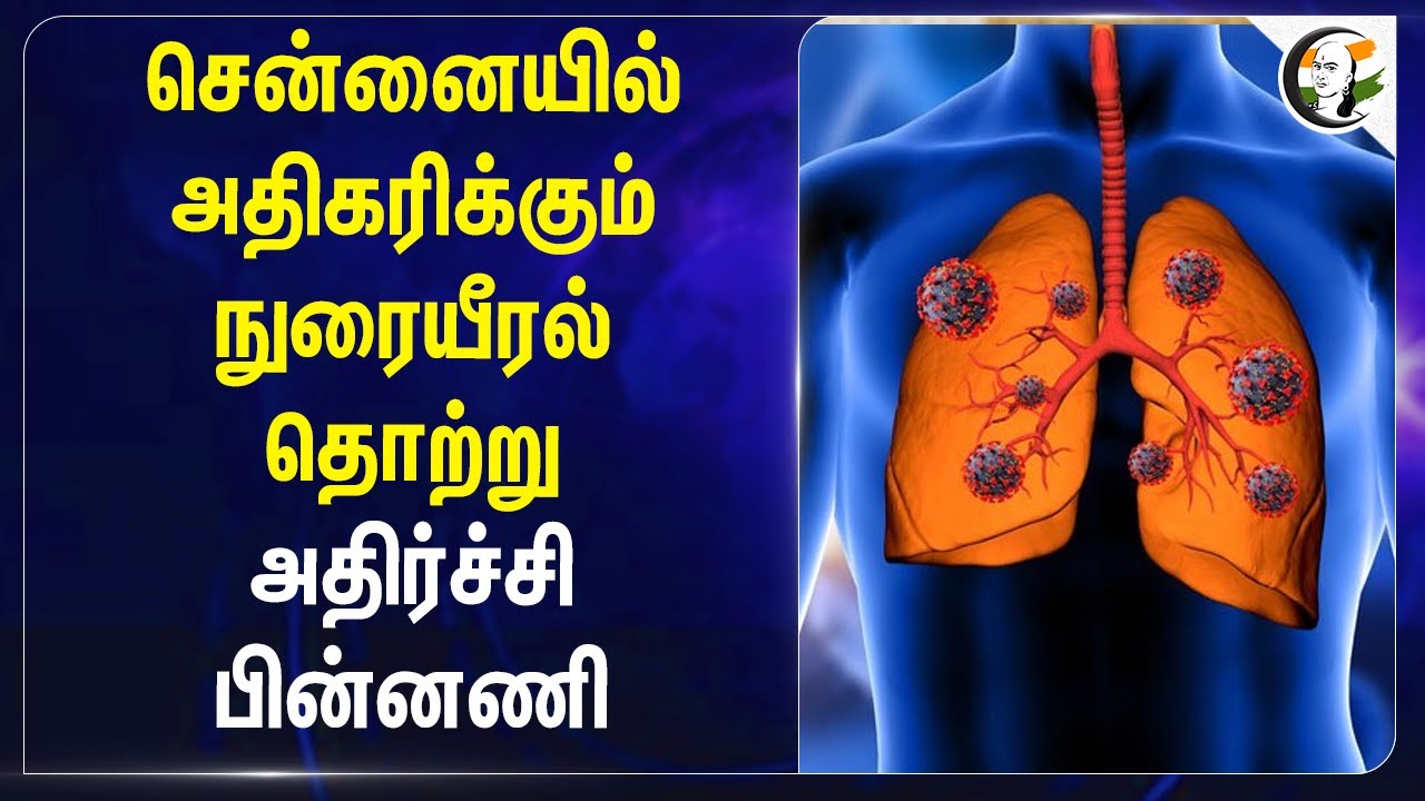 Chennai-யில் அதிகரிக்கும் நுரையீரல் தொற்று! அதிர்ச்சி பின்னணி | Influenza virus
