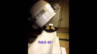 Aufnahmen Gamma Kamera