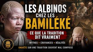 Albinos Among the Bamileke: What Tradition Really Says Albinos Among the Bamileke: What Tradition Really Says