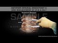 Anterior Cervical Discectomy & Disc Replacement at C5-6 & C6-7 - Medical Animation