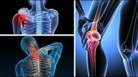 [ Nội ] TH TLS Khám Cơ xương khớp