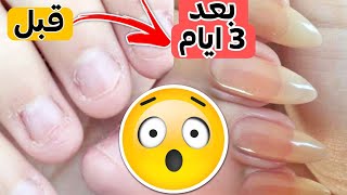 طولي اظافر في 3 ايام وصفة لتطويل الاظافر مجربة و مضمونه 100% لتبييض و لمعان أظافرك من اول مره 🔥🤍✨️ screenshot 3