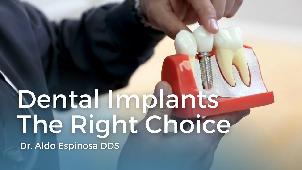 A Dental implant is hands down the best option available for replacing a missing tooth 1